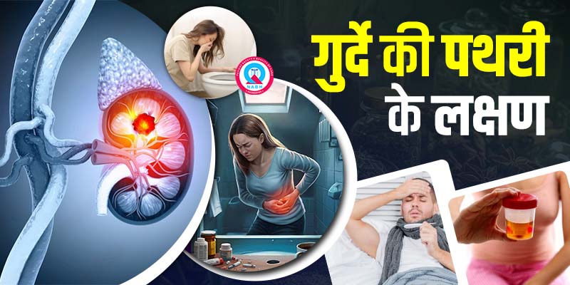 गुर्दे की पथरी के लक्षण - कर्मा आयुर्वेदा